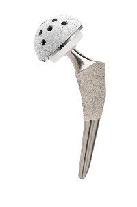 膝関節用インプラント