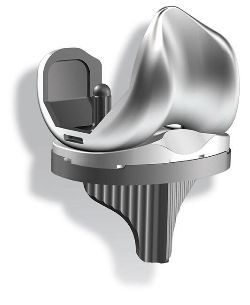 膝関節用インプラント